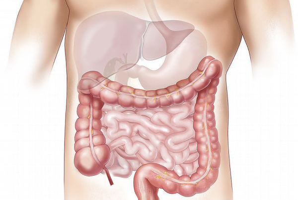 Journée mondiale des MICI : les maladies intestinales « cachées »