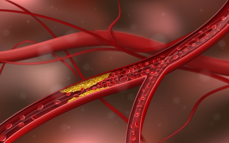 Thoracale en vasculaire heelkunde